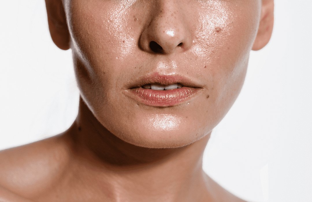 OILY SKIN AND HOW TO GET RID OF IT - Yves Rocher Azerbaijan